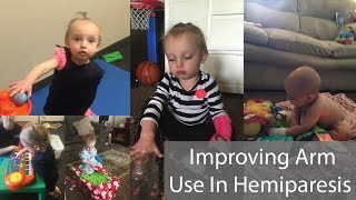 Improving Arm Use In Hemiparesis [upl. by Cone164]