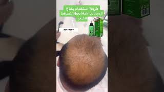 كيفية استخدام neo Hair Lotion [upl. by Nofets]