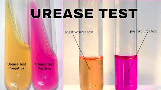 Proctor Compaction Test [upl. by Eelrahc]