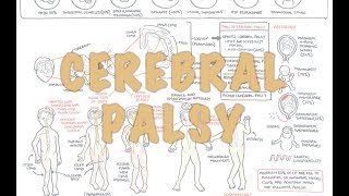 Cerebral Palsy  DETAILED Overview [upl. by Nalac]