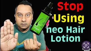 When to stop using Neo Hair Lotion Completely [upl. by Ecnedurp]