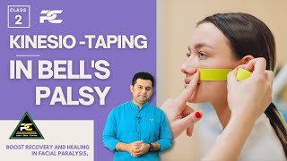 KINESIOTAPING TECHNIQUES FOR BELLS PALSY PATIENT  LEARN TAPING TO RECOVER FACIAL MOVEMENTS [upl. by Jp]