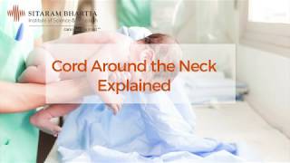 Cord Around Neck Explained [upl. by Ahker]